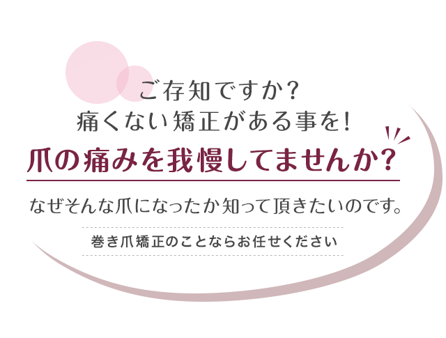 爪の痛みを我慢してませんか？なぜそんな爪になったか 知って頂きたいのです。ご存知ですか？痛くない矯正がある事を！巻き爪矯正のことならお任せください